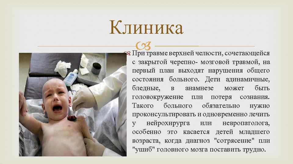 Клиника верхней челюсти, сочетающейся При травме с закрытой черепно- мозговой травмой, на первый план