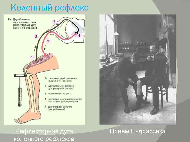 Рефлекторные приемы. Коленный рефлекс физиология. Схема коленного рефлекса физиология. Механизм коленного рефлекса. Исследование коленного рефлекса.