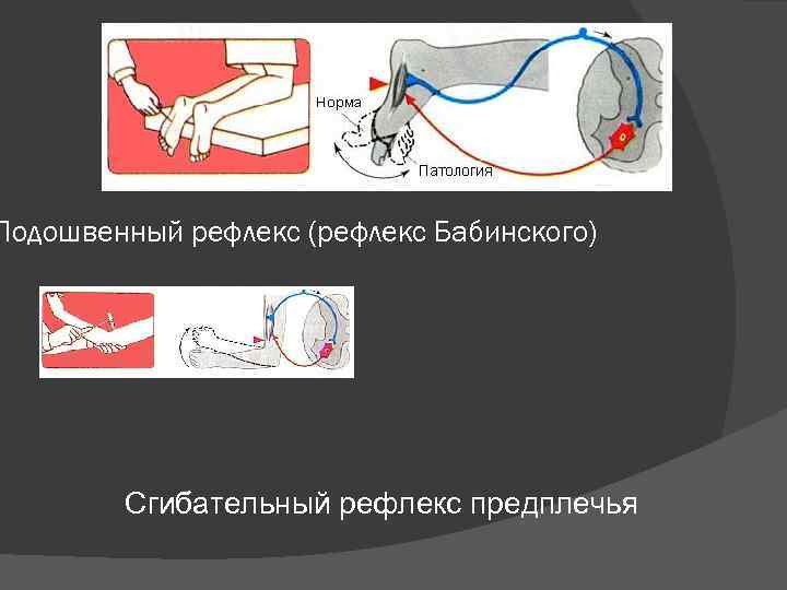 Схема дуги ахиллова рефлекса