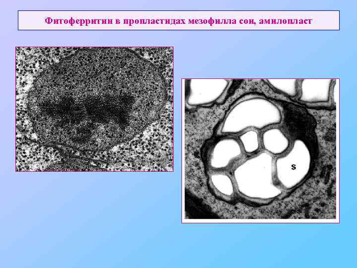 Фитоферритин в пропластидах мезофилла сои, амилопласт 