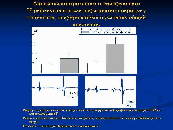 Динамика контрольного и тестирующего Н-рефлексов в послеоперационном периоде у пациентов, оперированных в условиях общей