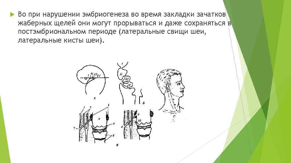  Во при нарушении эмбриогенеза во время закладки зачатков жаберных щелей они могут прорываться