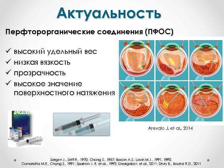 Актуальность Перфторорганические соединения (ПФОС) ü высокий удельный вес ü низкая вязкость ü прозрачность ü