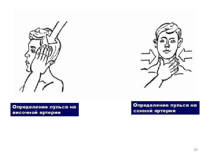Рис. 11. 4. Область сердечного толчка Определение пульса на височной артерии Определение пульса на