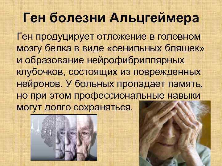 Ген болезни Альцгеймера Ген продуцирует отложение в головном мозгу белка в виде «сенильных бляшек»