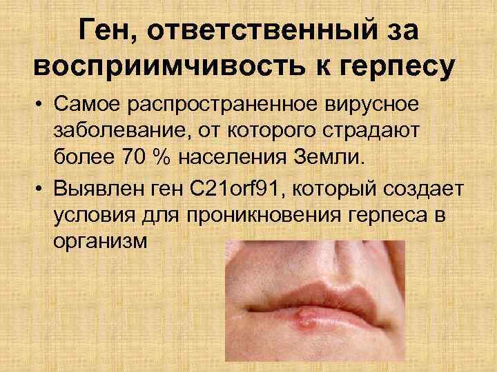 Ген, ответственный за восприимчивость к герпесу • Самое распространенное вирусное заболевание, от которого страдают
