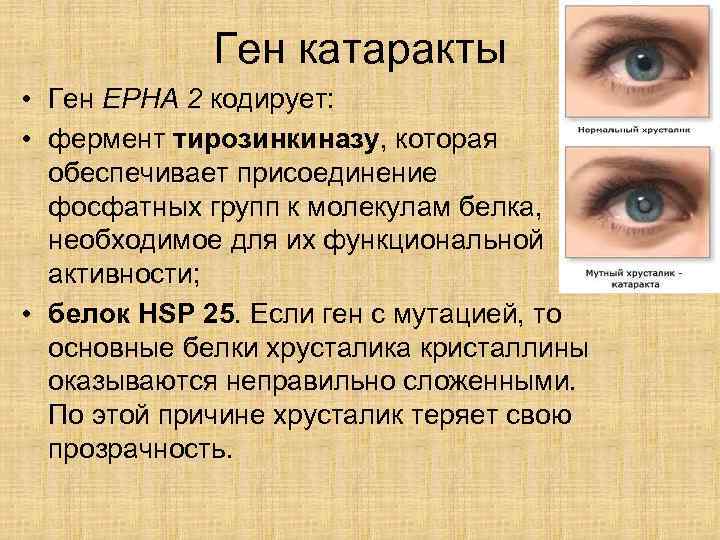 Ген катаракты • Ген EPHA 2 кодирует: • фермент тирозинкиназу, которая обеспечивает присоединение фосфатных