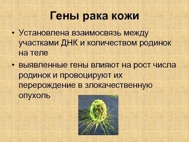 Гены рака кожи • Установлена взаимосвязь между участками ДНК и количеством родинок на теле