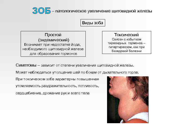 – патологическое увеличение щитовидной железы Виды зоба Простой (эндемический) Возникает при недостатке йода, необходимого