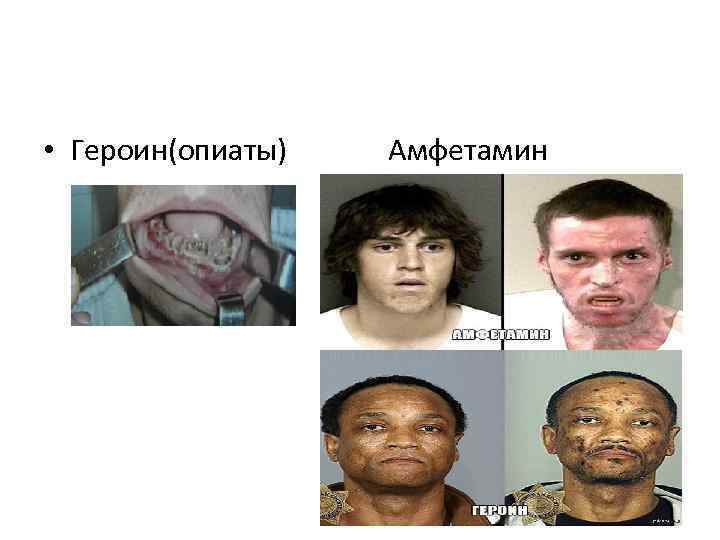 • Героин(опиаты) Амфетамин 