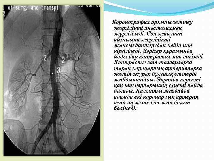 После коронографии нельзя