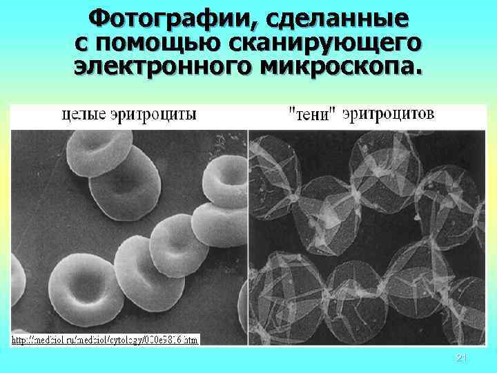 Фотографии, сделанные с помощью сканирующего электронного микроскопа. 21 