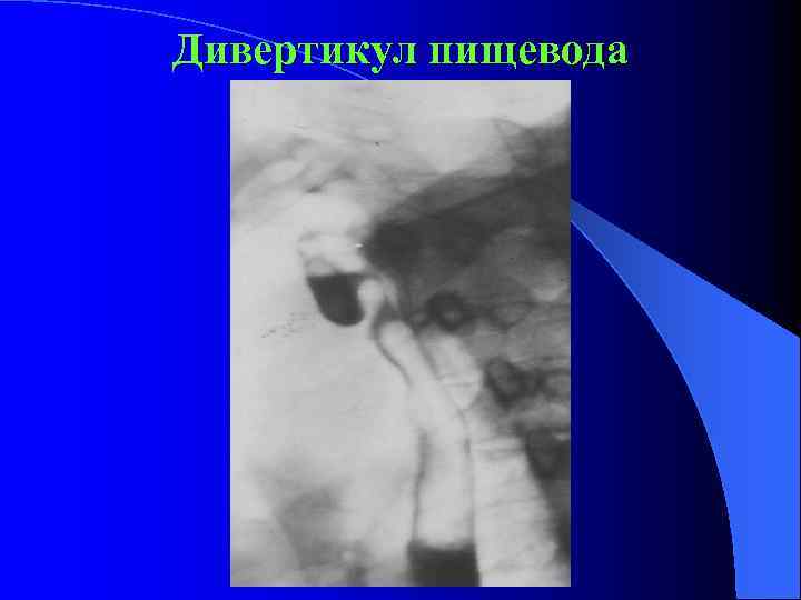 Лучевая диагностика жкт презентация