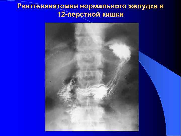 Лучевая диагностика жкт презентация