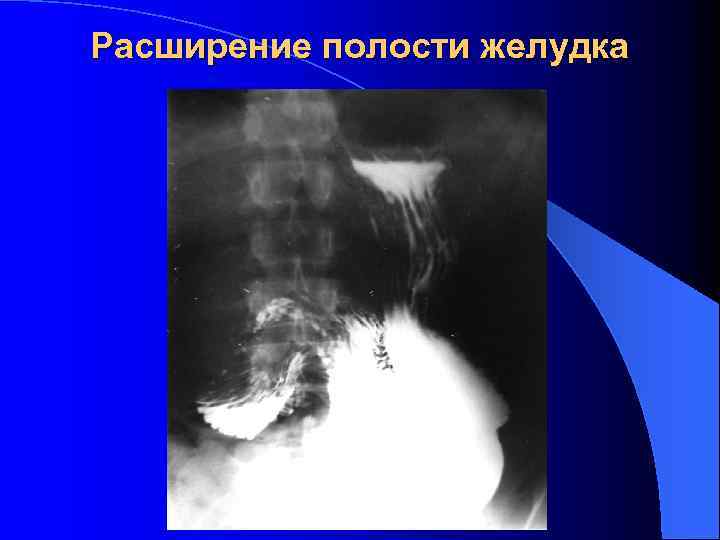 Лучевая диагностика жкт презентация