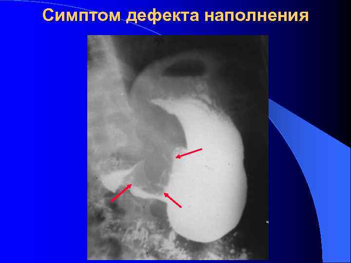 Лучевая диагностика жкт презентация