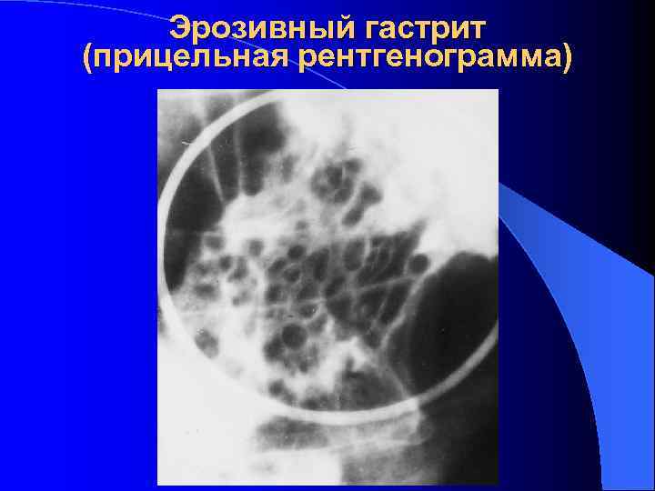 Лучевая диагностика заболеваний жкт презентация