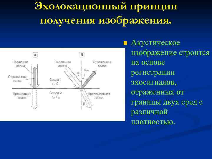 Получение принцип. Принципы получения изображения. Метод эхолокационной диагностики.. Акустическая плотность. Лучевая разрешающая способность ультразвукового метода улучшается.