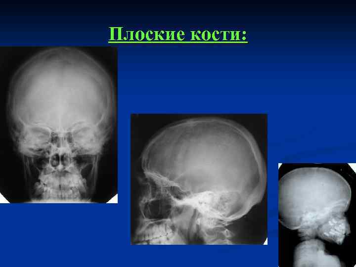 Плоские кости: 