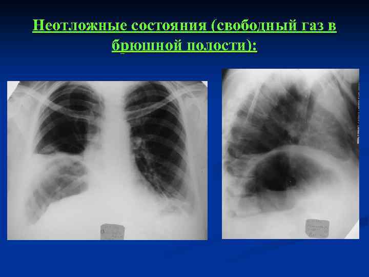 Презентация лучевая диагностика неотложных состояний