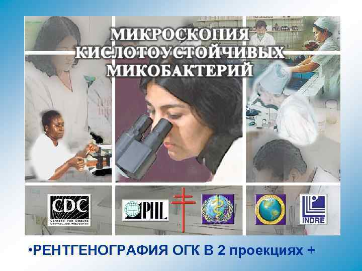  • РЕНТГЕНОГРАФИЯ ОГК В 2 проекциях + 