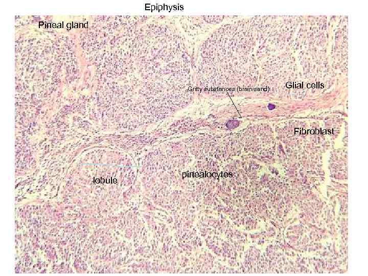 Epiphysis Pineal gland Gritty substances (brain sand) Glial cells Fibroblast lobule pinealocytes 