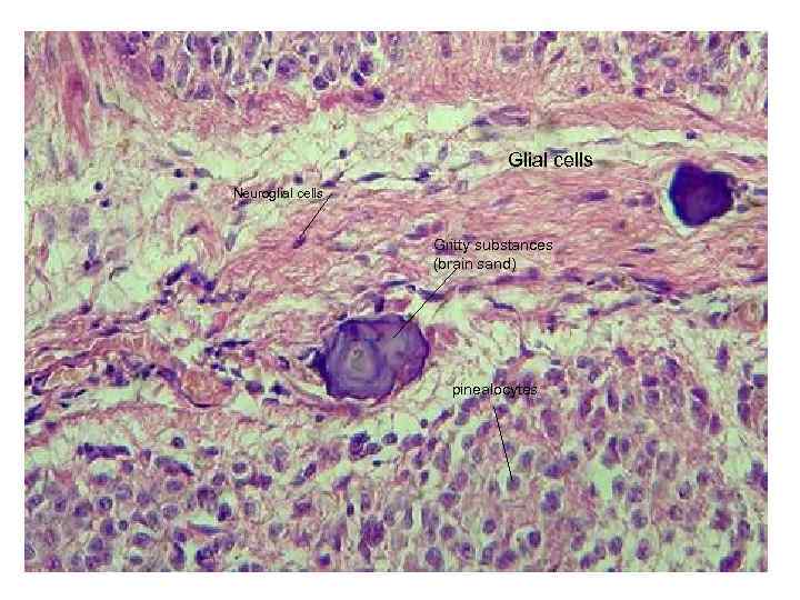 Glial cells Neuroglial cells Gritty substances (brain sand) pinealocytes 