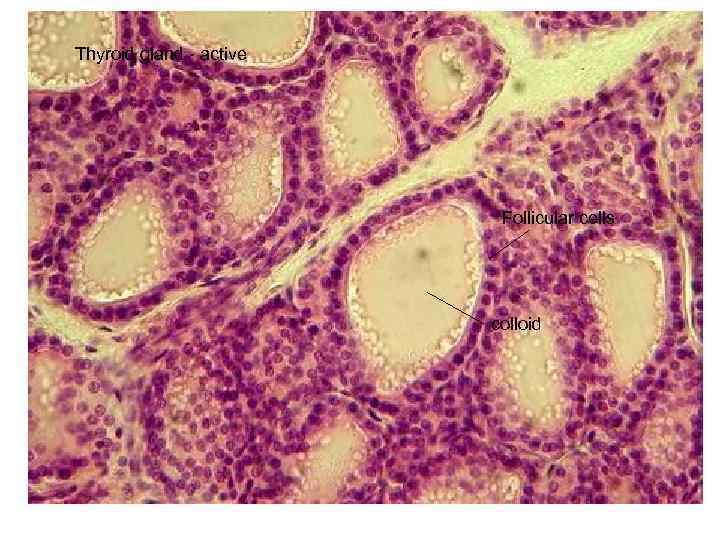 Thyroid gland - active Follicular cells colloid 