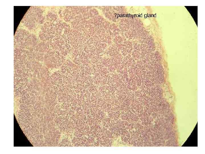 ? parathyroid gland 