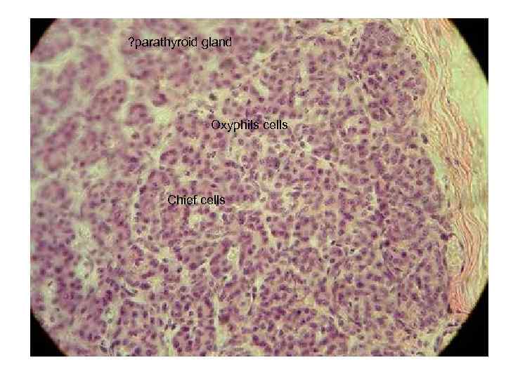 ? parathyroid gland Oxyphils cells Chief cells 