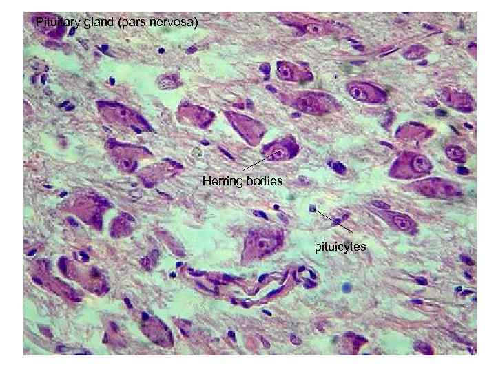 Pituitary gland (pars nervosa) Herring bodies pituicytes 