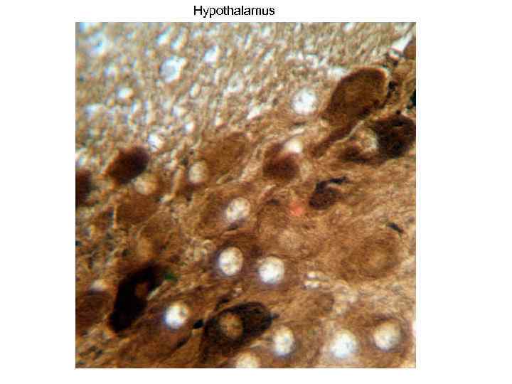 Hypothalamus 