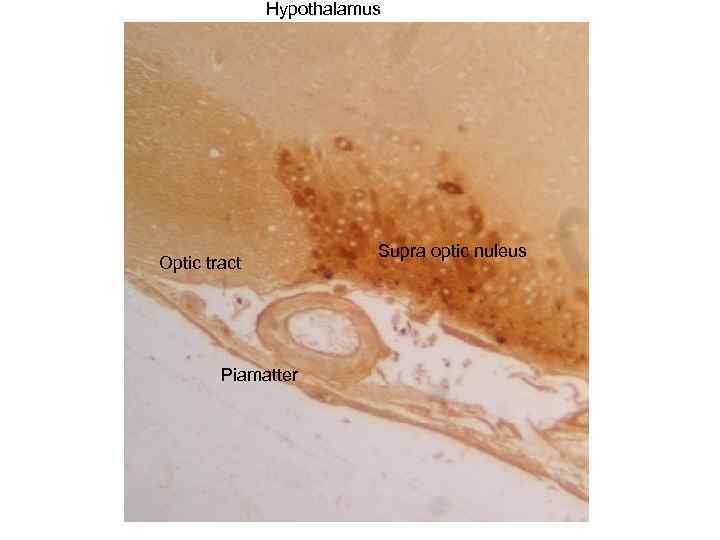 Hypothalamus Optic tract Piamatter Supra optic nuleus 