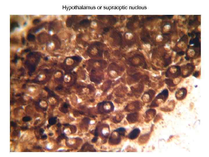 Hypothalamus or supraoptic nucleus 