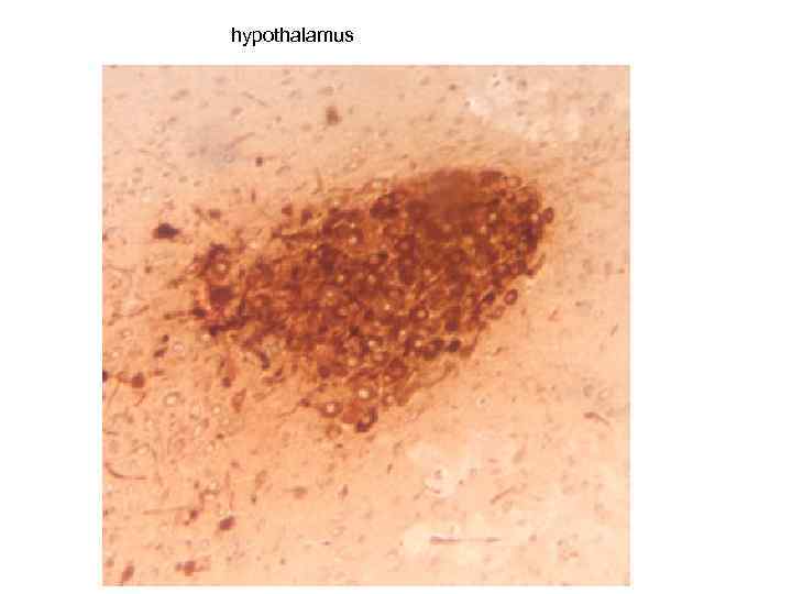 hypothalamus 