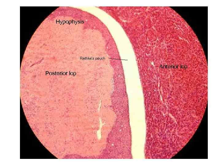 Hypophysis Rathke’s pouch Anterior lop Posterior lop 