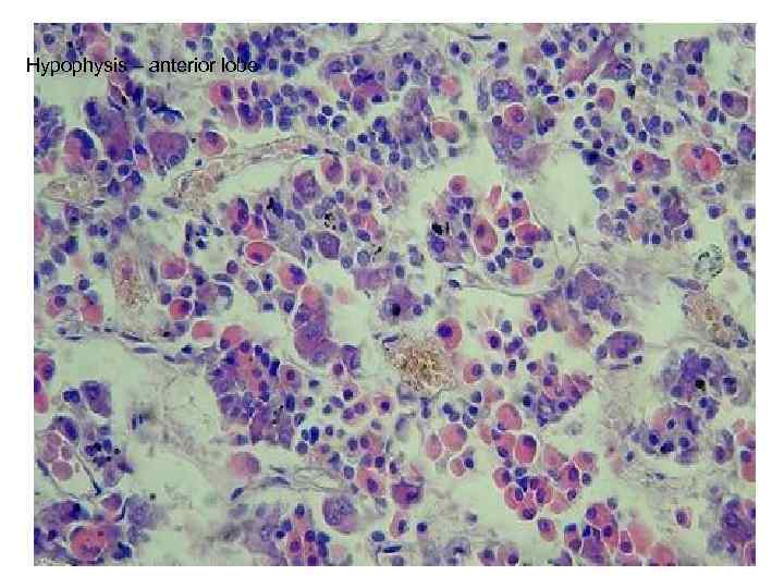 Hypophysis – anterior lobe 