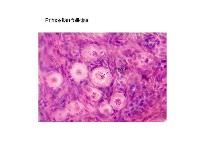 Primordian follicles oocytes 