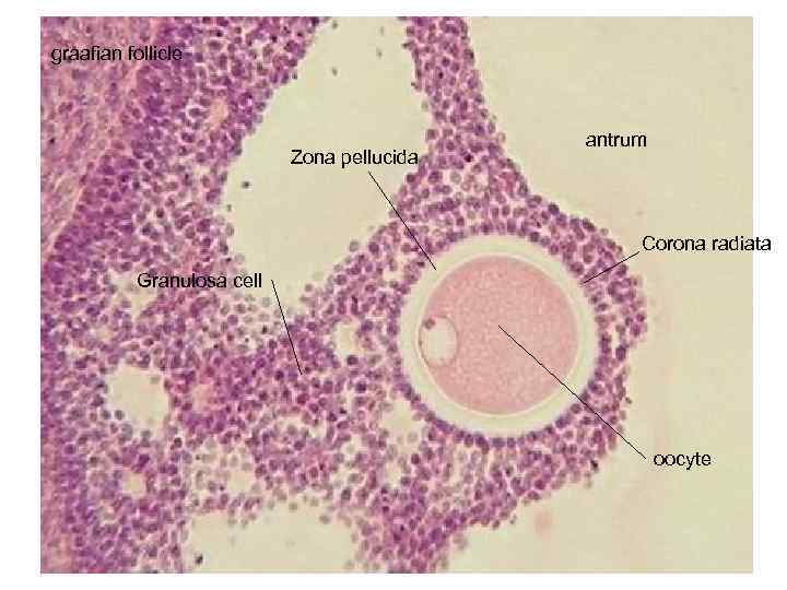 ovary Germinal epithelium Primordial follicles Tunica albuginea cortex