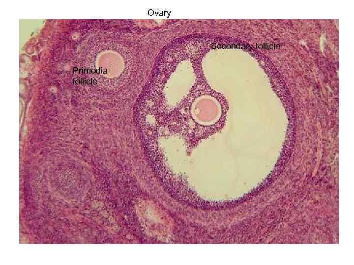 Ovary Secondary follicle Primodia follicle 