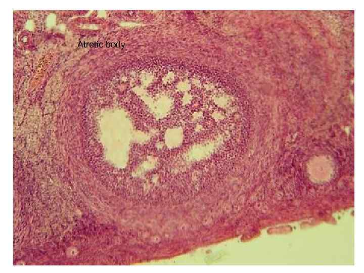 Atretic body 