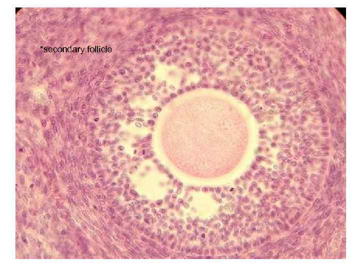 ovary Germinal epithelium Primordial follicles Tunica albuginea cortex