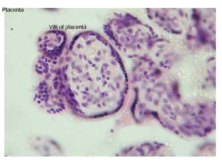 Placenta * Villi of placenta 