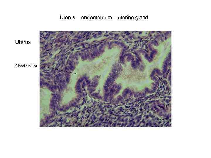 Uterus – endometrium – uterine gland Uterus Gland tubules 