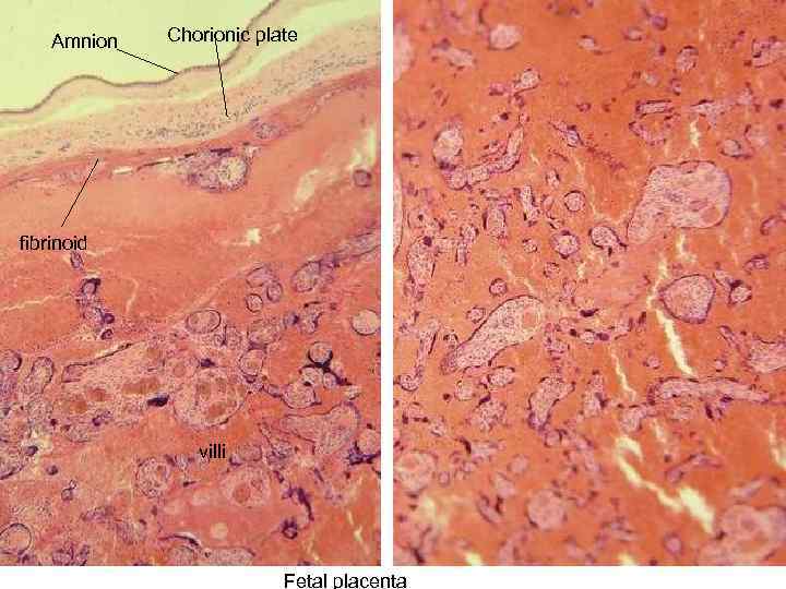 Amnion Chorionic plate fibrinoid villi Fetal placenta 