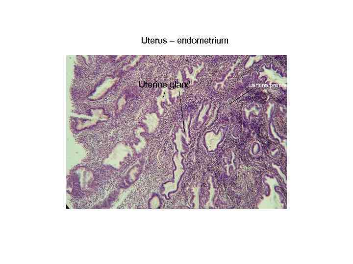 Uterus – endometrium Uterine gland Lamina propria 