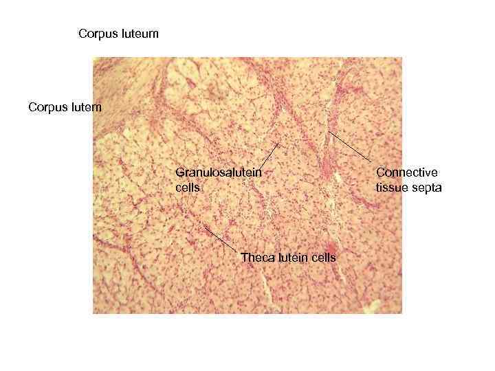 Corpus luteum Corpus lutem Granulosalutein cells Theca lutein cells Connective tissue septa 