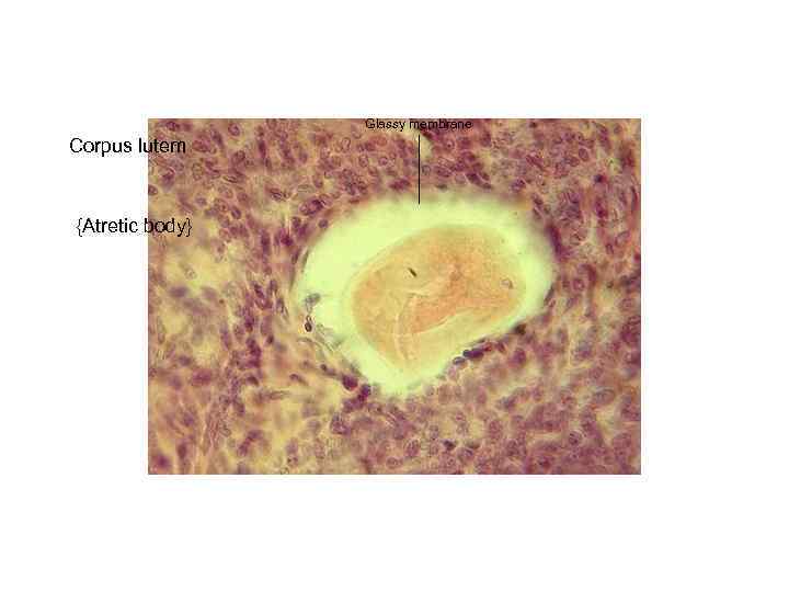 Glassy membrane Corpus lutem {Atretic body} 