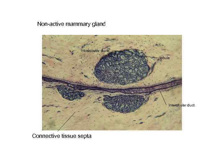 Non-active mammary gland Intralobular ducts lobule Interobular duct Connective tissue septa 