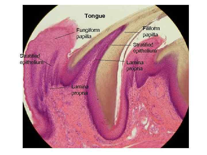 Tongue Fungiform papilla Filiform papilla Stratified epithelium Lamina propria 